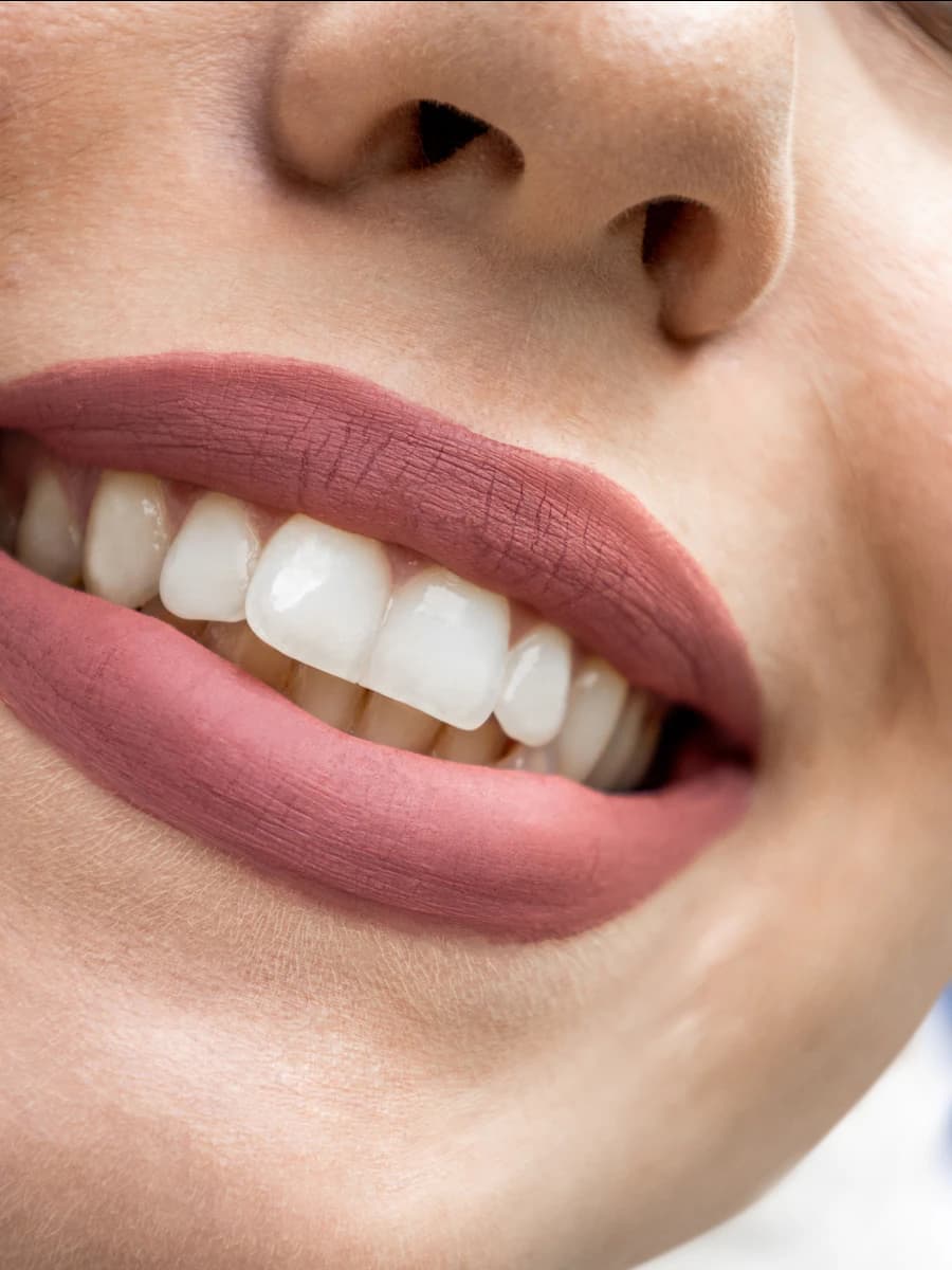 A healthy, natural smile after implant treatment
